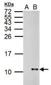 Anti-Influenza A virus NS2 / NEP antibody used in Western Blot (WB). GTX125953